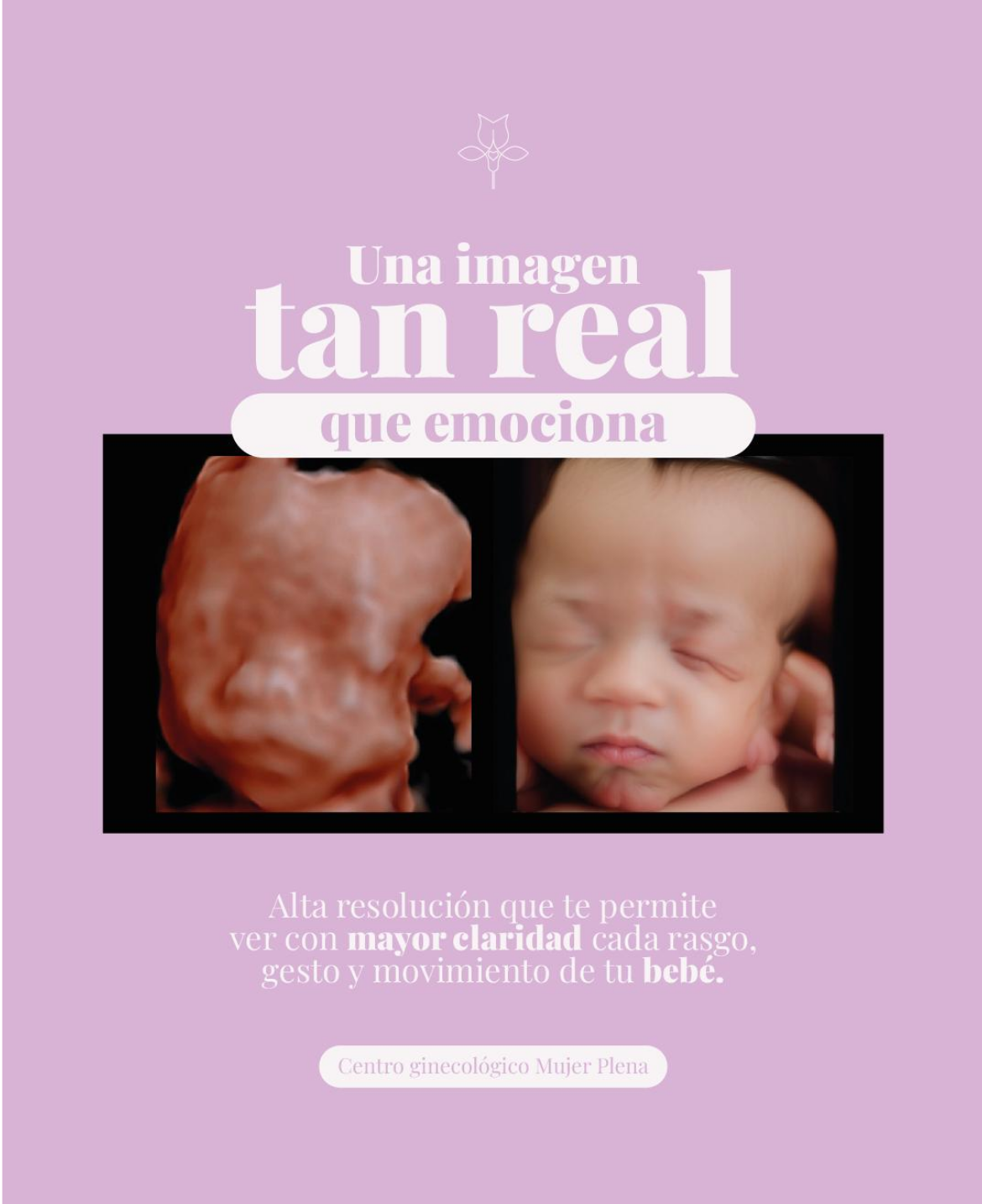 Ecografía ginecológica en Chiclayo